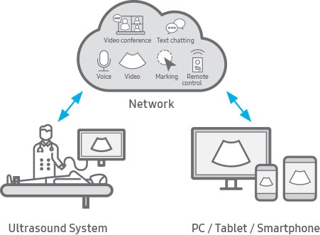 Remote control of ultrasound system SonoSync™ ¹ 