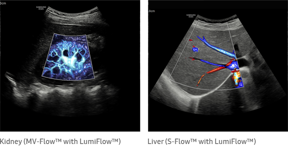 3d imaging LumiFlow™