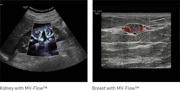 accurate diagnosis MV-Flow™ ¹