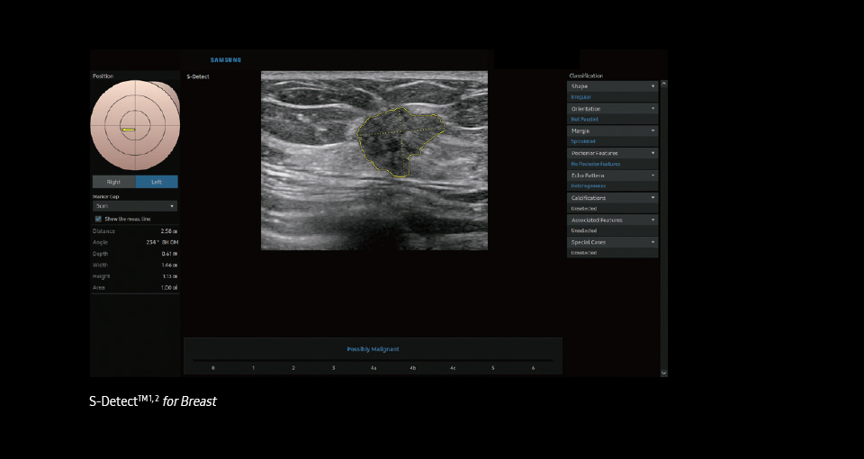 S-Detect™ ¹ for Breast