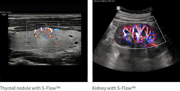 accurate diagnosis S-Flow™