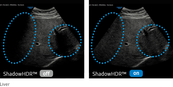 ShadowHDR™