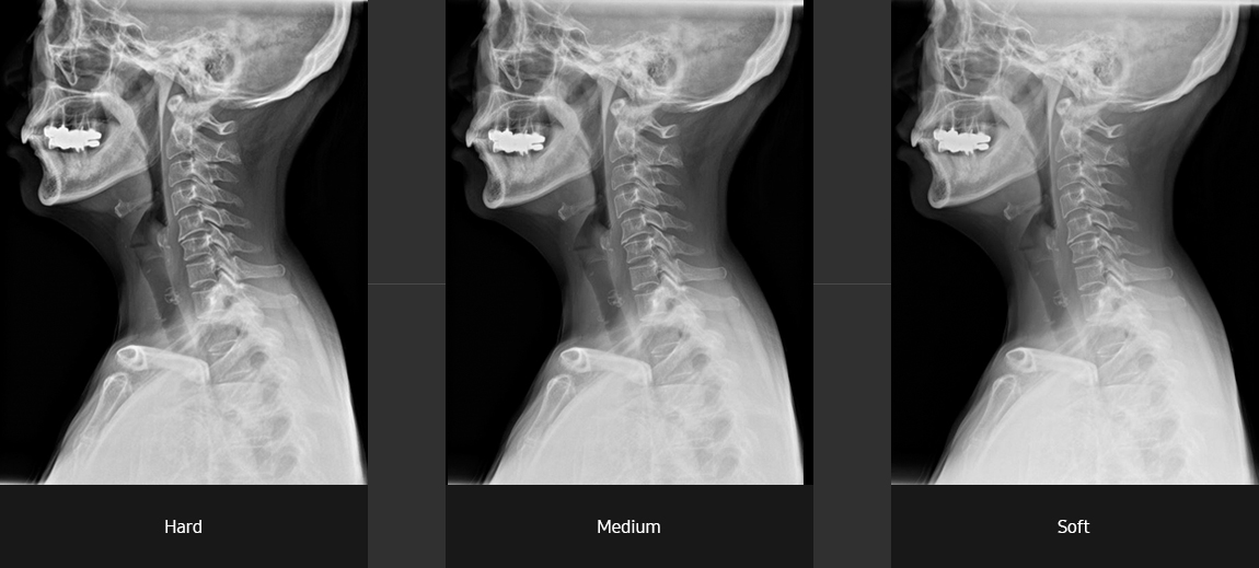 Cervical spine lateral Sample
