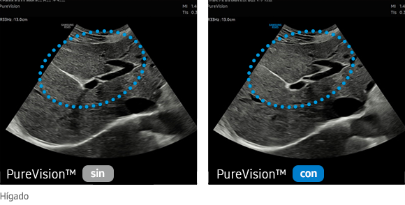 sin PureVision™, con PureVision™, Hígado