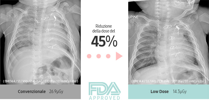 45% Dose Reduction