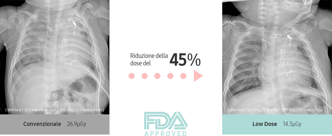 45% Dose Reduction