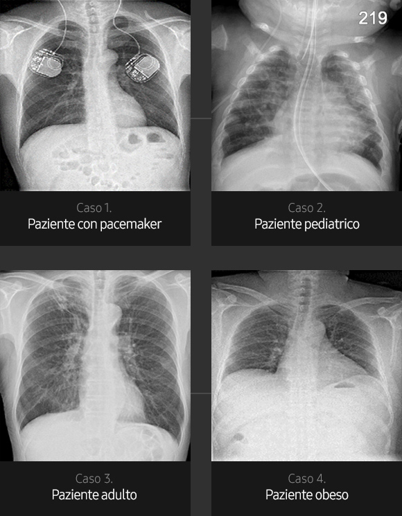 Immagini radiografiche in diverse condizioni di esame