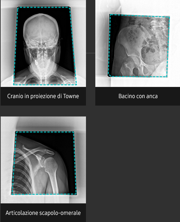 Immagini radiografiche in diverse condizioni di esame