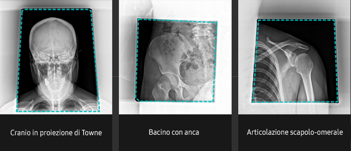 Immagini radiografiche in diverse condizioni di esame