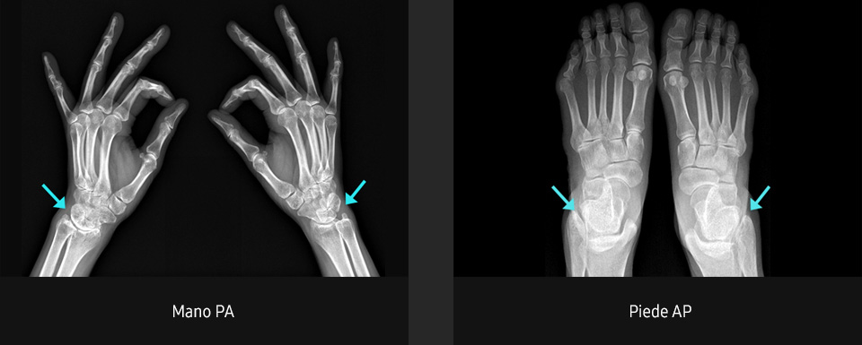 Immagini radiografiche in diverse condizioni di esame con elevata definizione e chiarezza