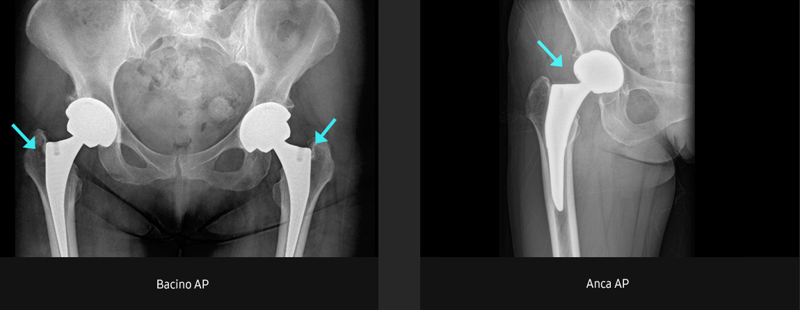 Immagini radiografiche in diverse condizioni di esame con elevata definizione e chiarezza
