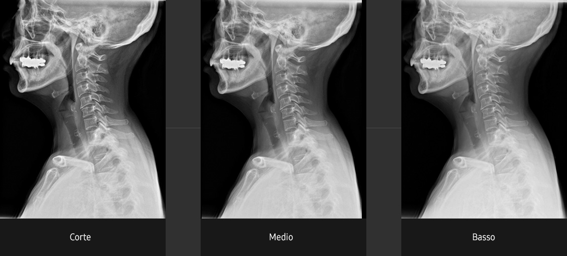 Immagini radiografiche in diverse condizioni di esame con elevata definizione e chiarezza