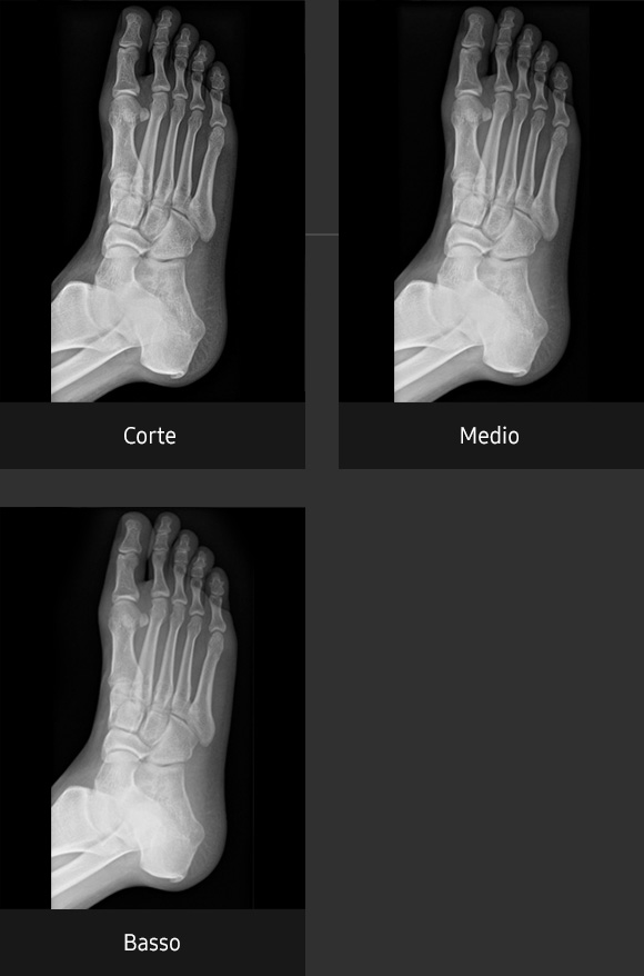 Immagini radiografiche in diverse condizioni di esame con elevata definizione e chiarezza