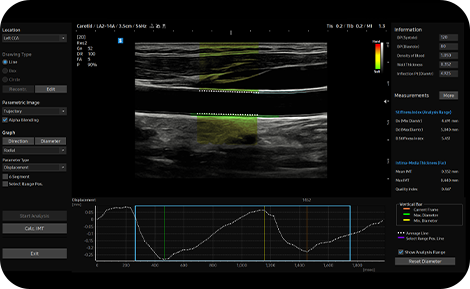 medical solution : ArterialAnalysis™ 