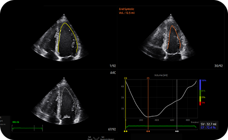 medical diagnostics : AutoEF