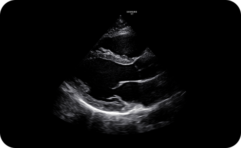 precise imaging : S-Harmonic™