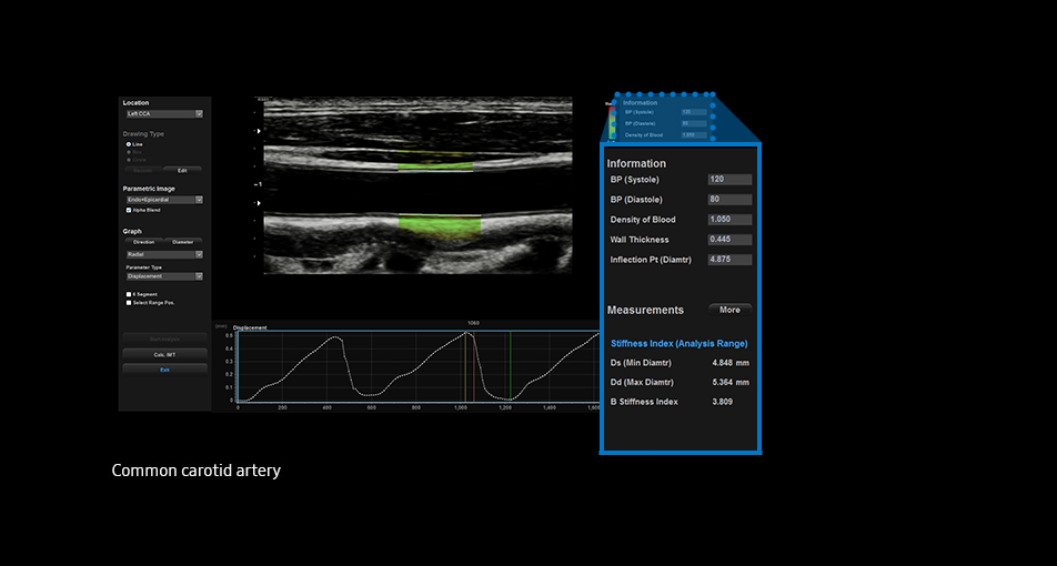 Arterial Analysis™ providing advanced medical solutions