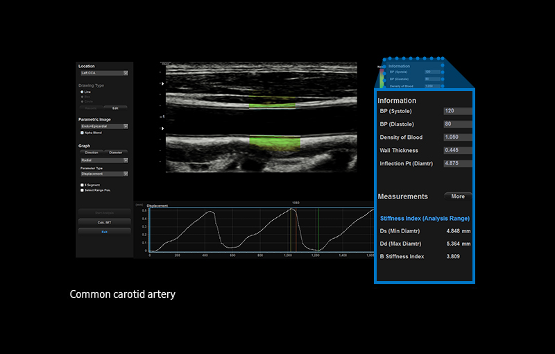 Arterial Analysis™ providing advanced medical solutions