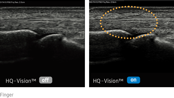 medical diagnostics : HQ-Vision™