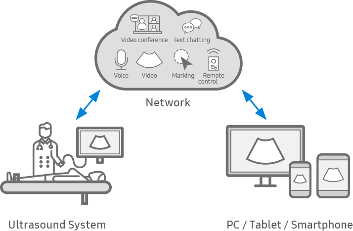 remote control of ultrasound system : SonoSync™ 