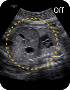 powerful imaging : ClearVision - off