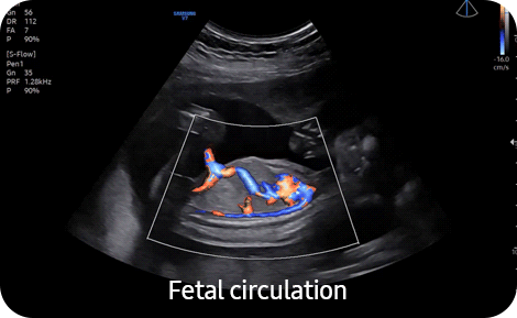 powerful imaging : MV-Flow™