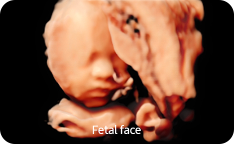 3d imaging : RealisticVue™ 