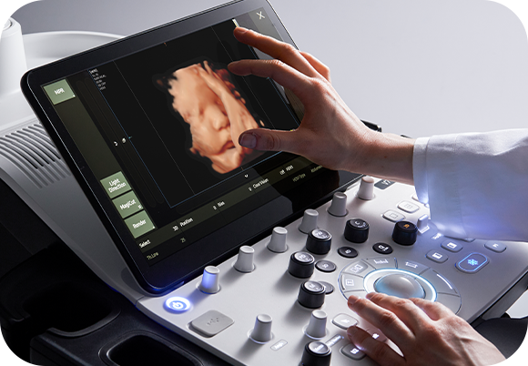 ob gyn ultrasound: V7