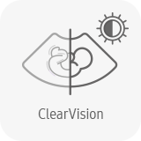 ClearVision